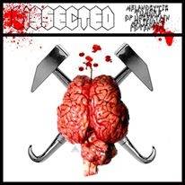 Dissected (GRC) : Dissected - Melanocytic Tumors of Uncertain Malignant Potential